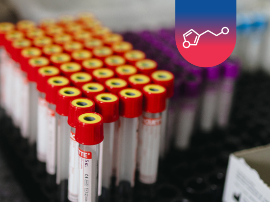 Histamin (vyšetření DAO + THDC = diaminooxidáza + degradace histaminu) + krátká interpretace