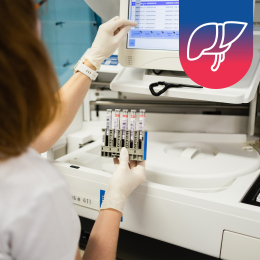 Jaterní testy z krve