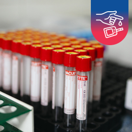 Test na cukrovku z krve